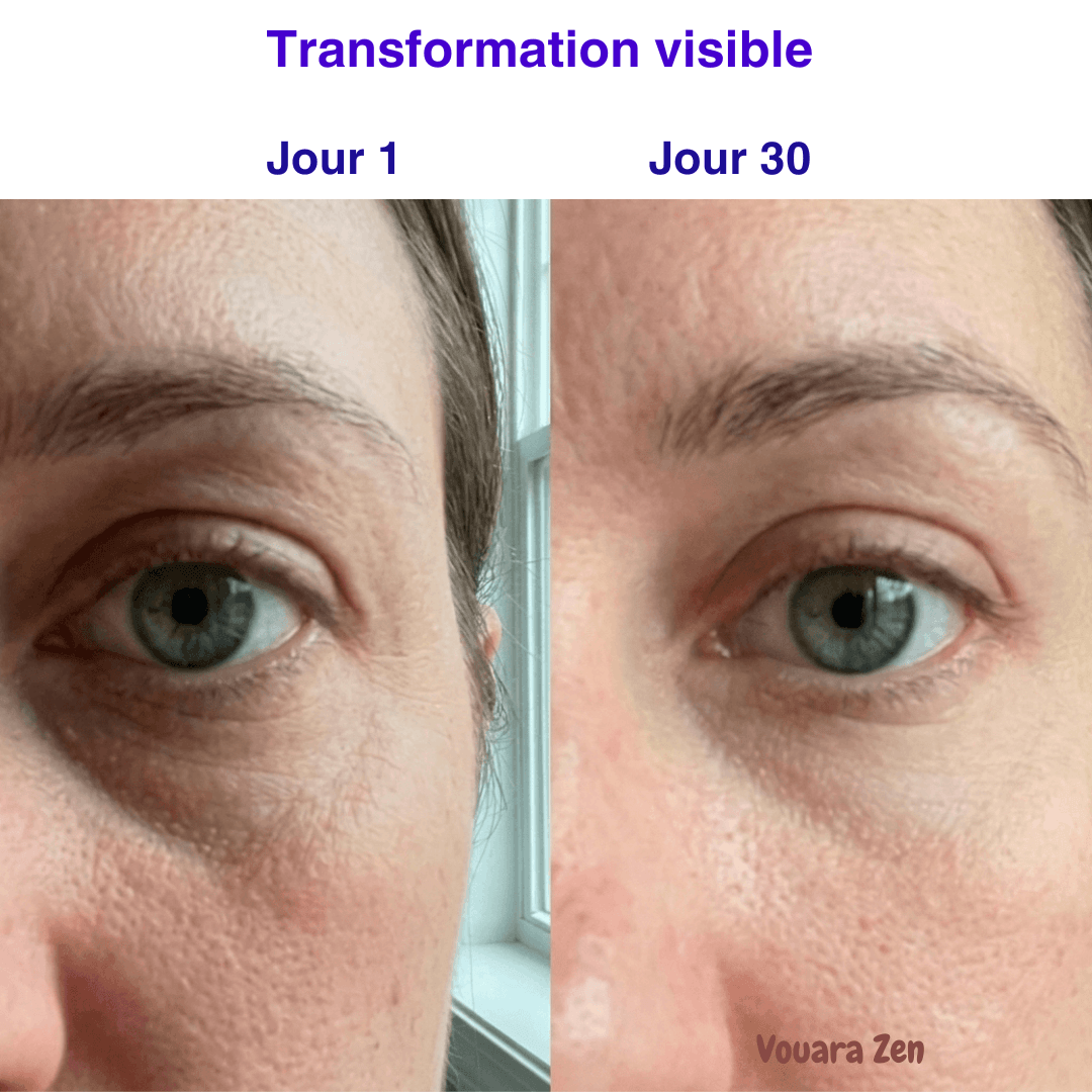 Vouara Zen™ | Kit Sommeil Voyage